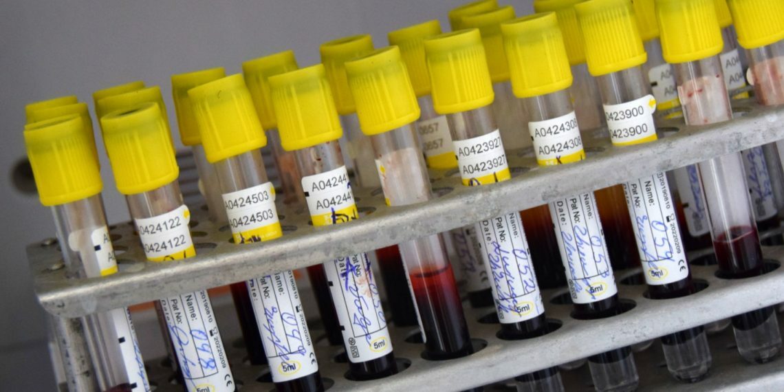 Պատերազմը ևս մեկ անգամ ընդգծեց արյան փոխներարկման  կայանի խնդիրները